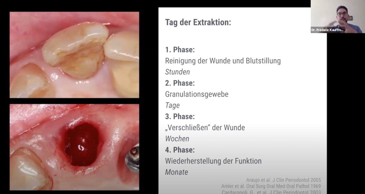 Komplikationsprävention