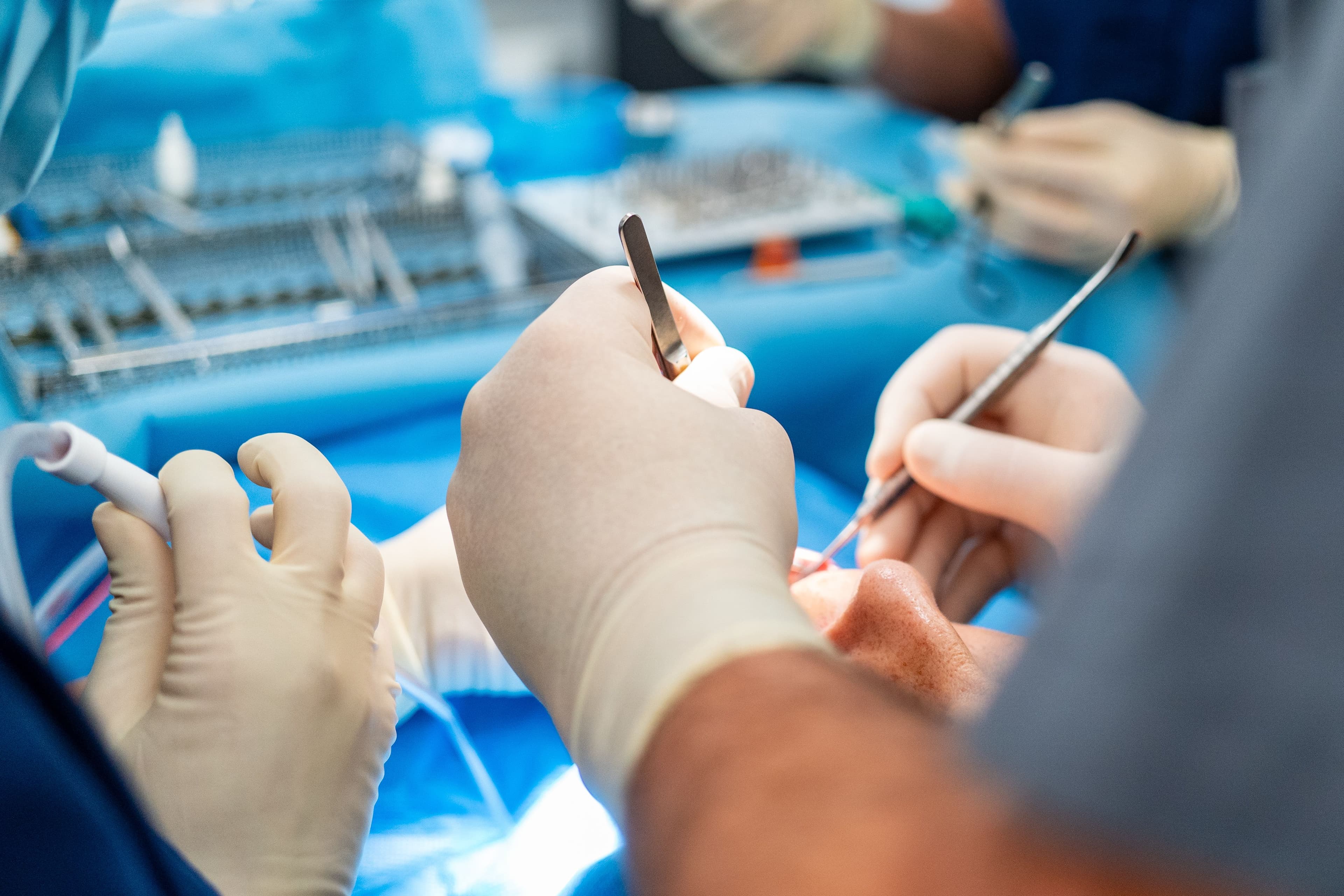 Nahaufnahme eines chirurgischen Eingriffs, behandschuhte Hände führen Instrumente am Patientenmund, im Hintergrund steriles Instrumententray.