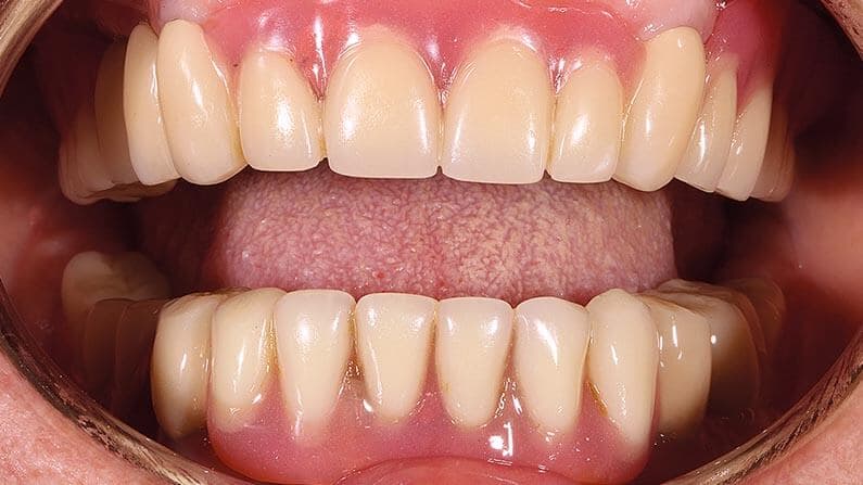 Miniimplantate Adjmal Sheerzoi