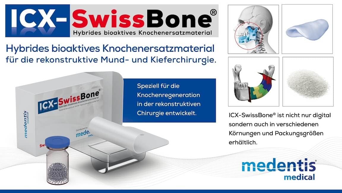 ICX-SwissBone