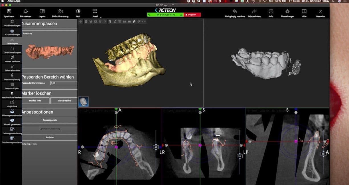 3D-Diagnostik