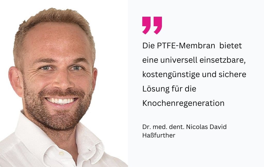 Augmentationsverfahren