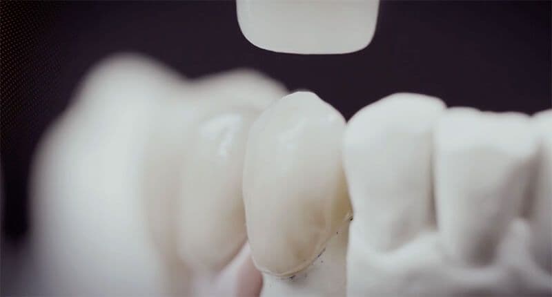imagefilm-dental-direkt