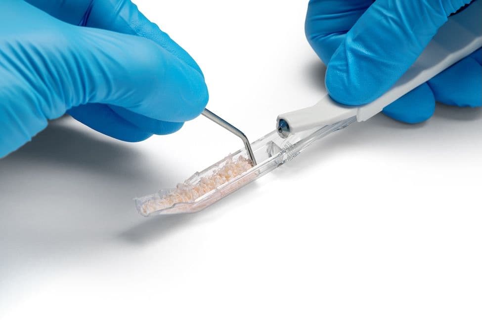 Bone Scraper