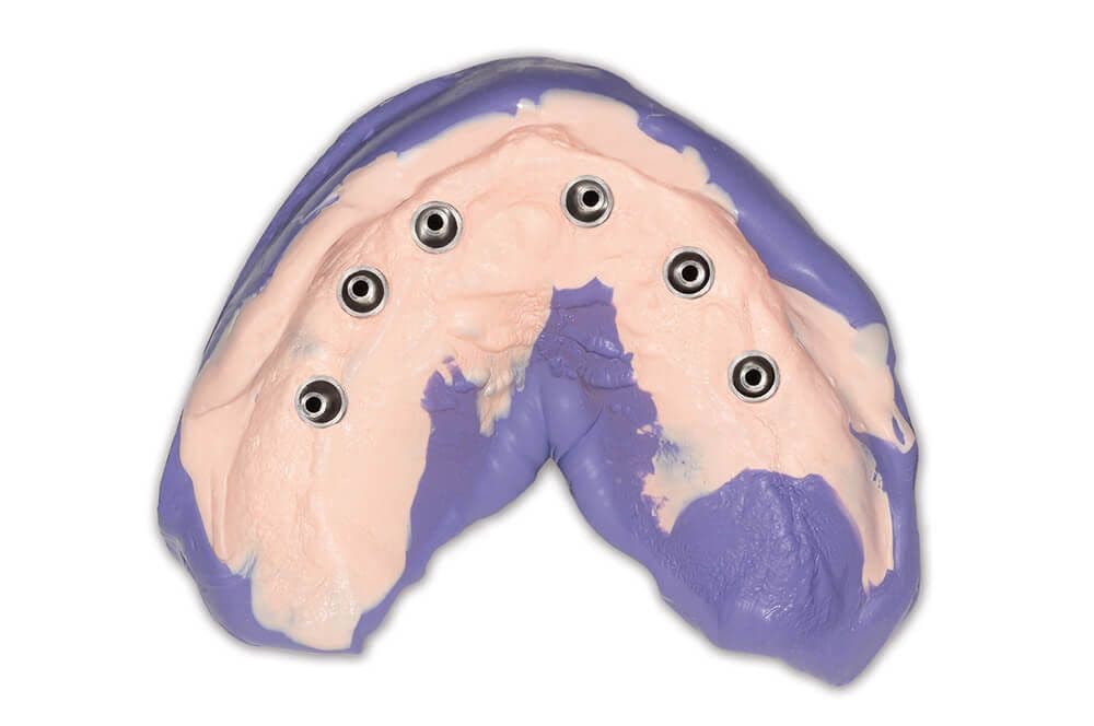 Hydrorise Implant
