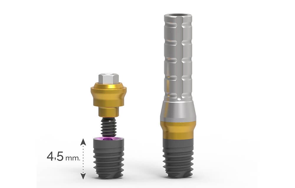 Abb. 1 Implantatspezifisches Abutment für ein 4,5 mm kurzes Implantat mit einer entsprechend verkürzten Abutmentschraube.