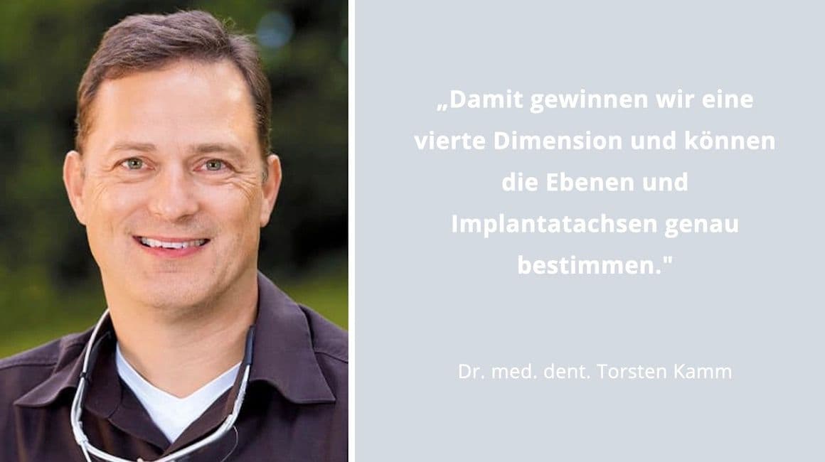 Schablonengeführte Implantologie