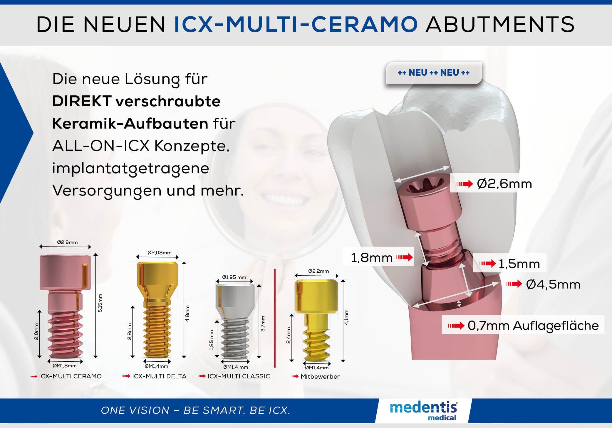 Infografik zu den ICX-Multi-Ceramo Abutments von medentis medical mit Maßangaben zu Durchmesser und Länge im Vergleich zu ICX-Multi Delta, Classic und einem Mitbewerber-Produkt sowie einer Querschnittsdarstellung im Zahn.
