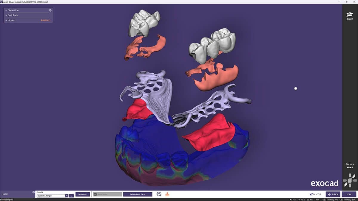 exocad_PartialCAD_Elefsina-software