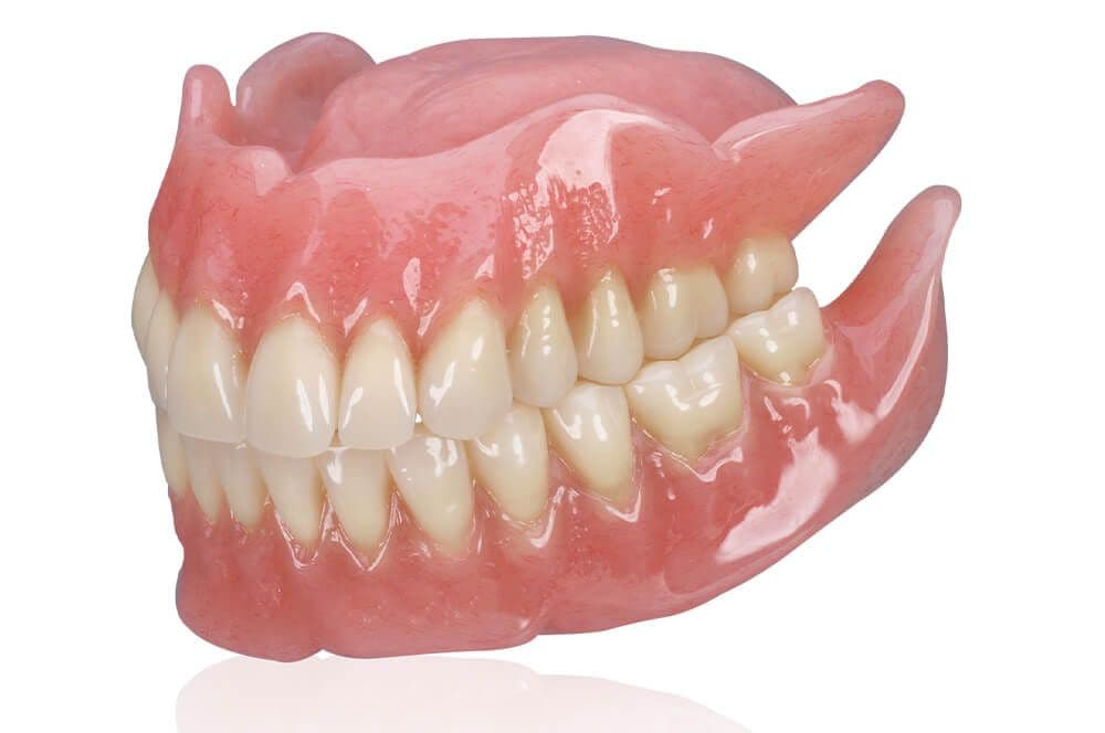Permadental, Evo fusion
