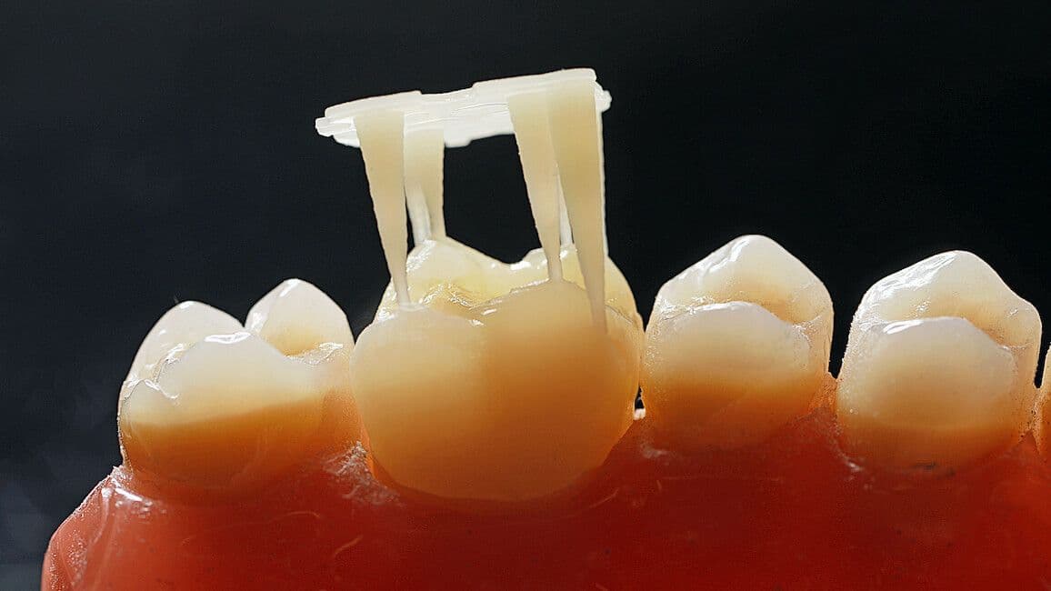 Cerec-Tag
