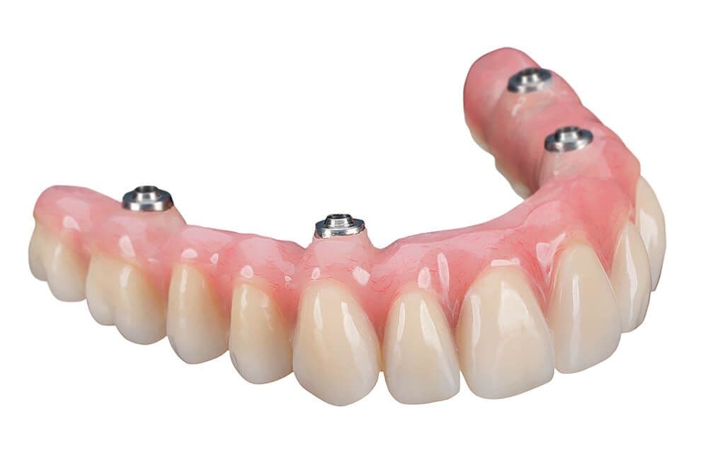 produktreport_2_2019_permadental_abb_1