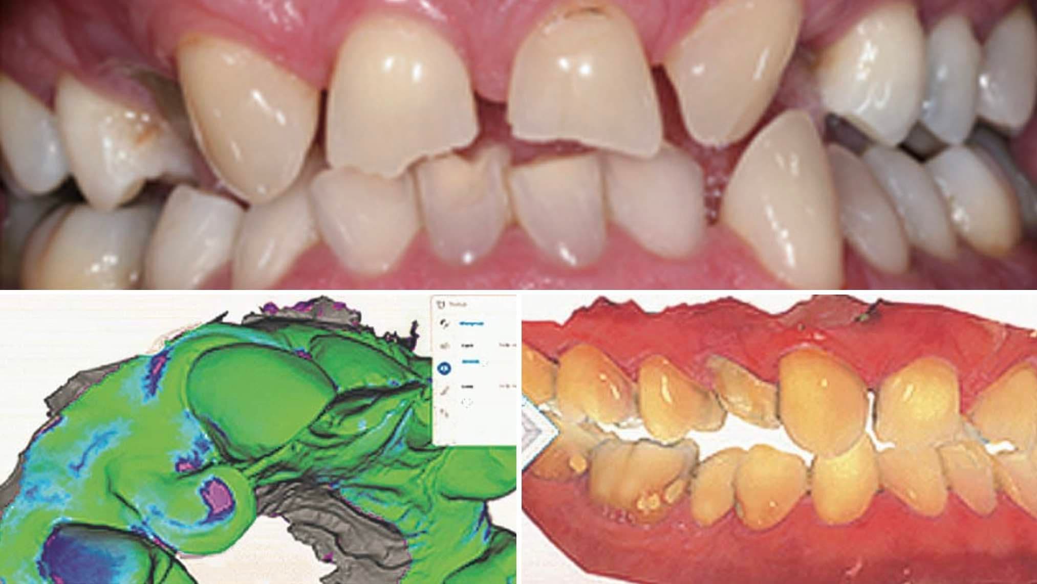 Cerec Master Kurs