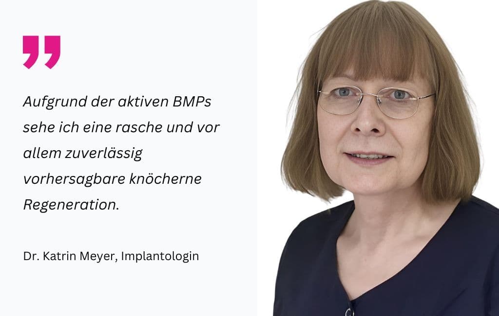 MIMI-Verfahren