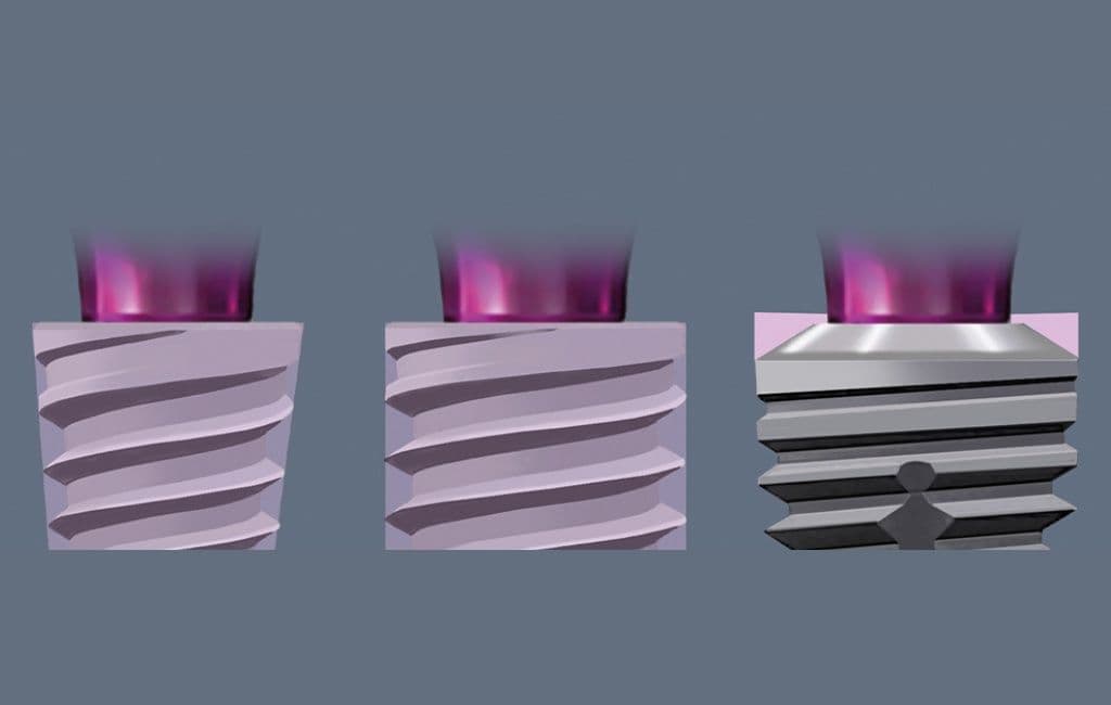 Bone Growth Concept