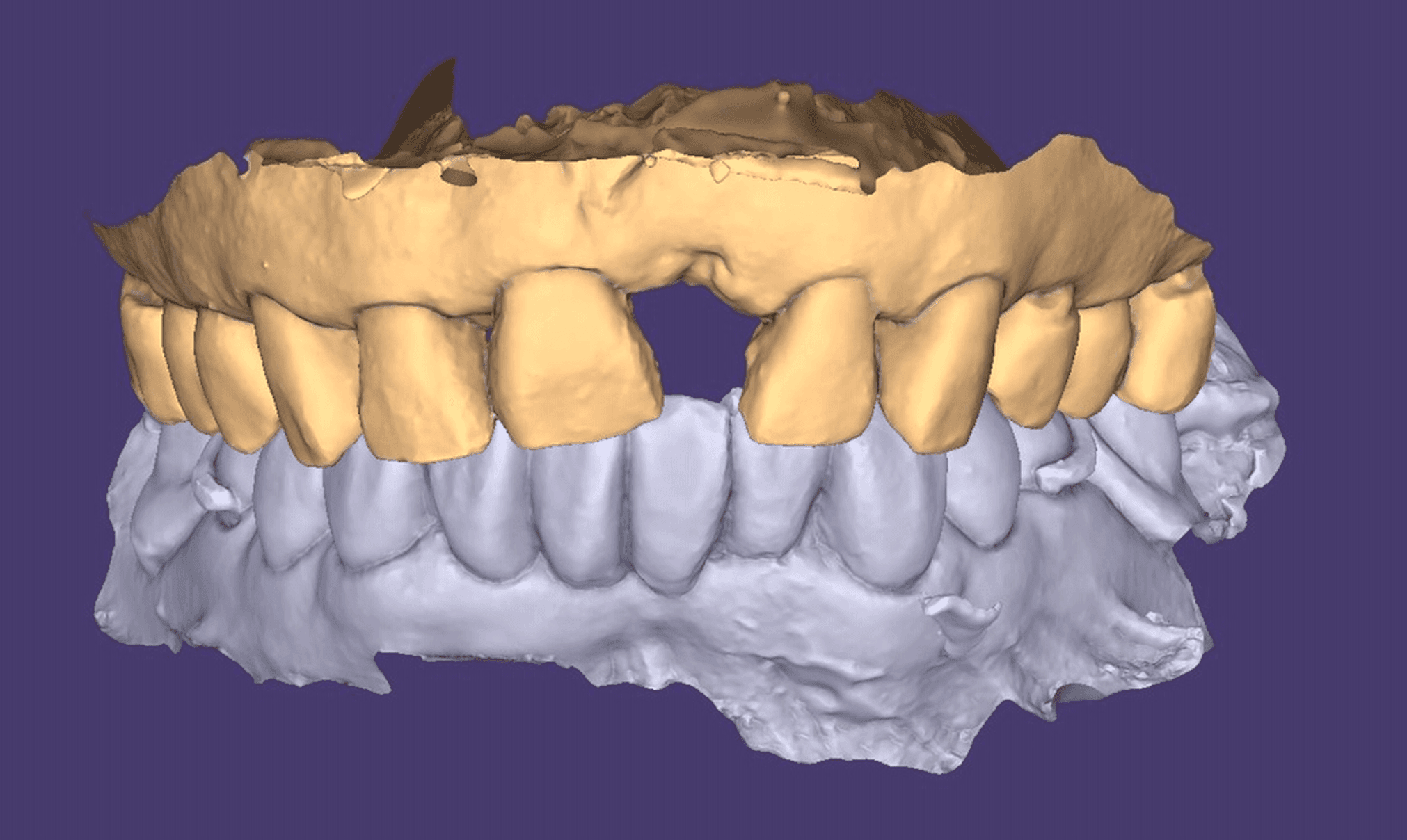 Permadental
