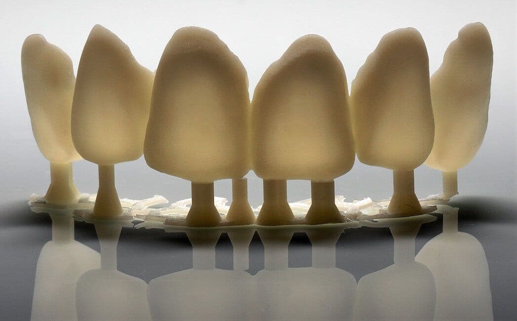 Cerec-Tag