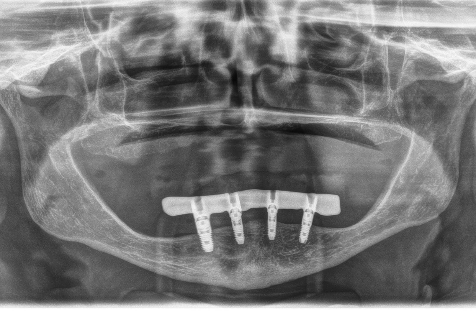 figura 15: Radiologische Kontrolle.