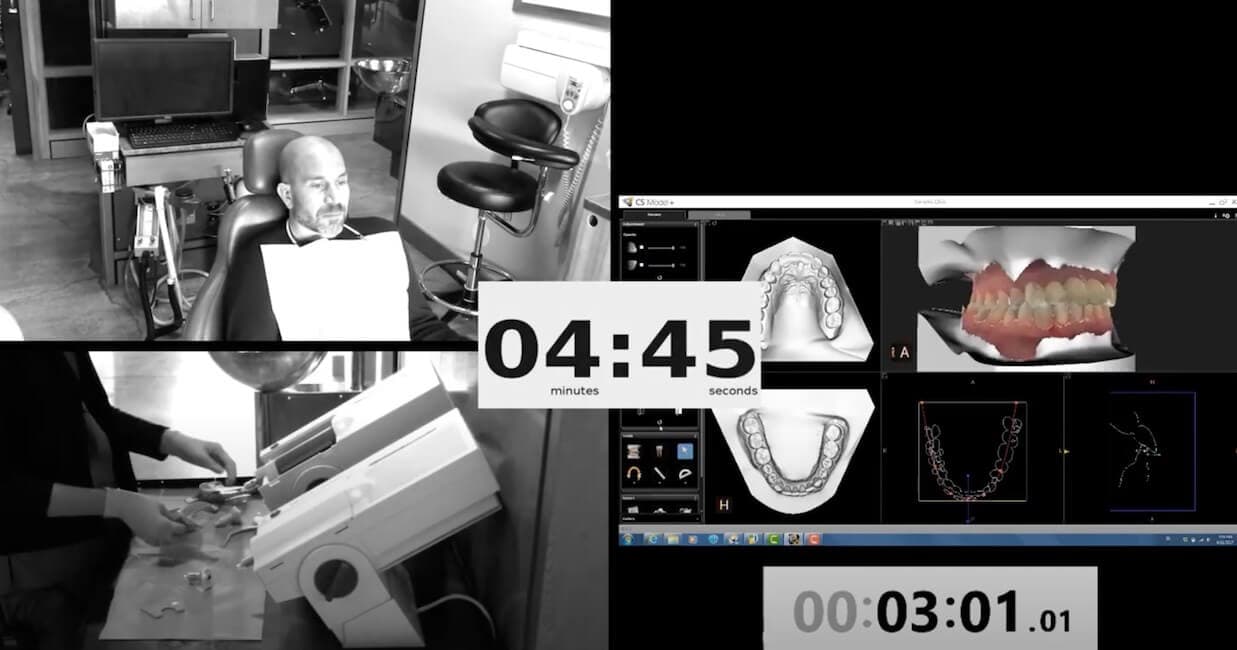 Intraoralscan