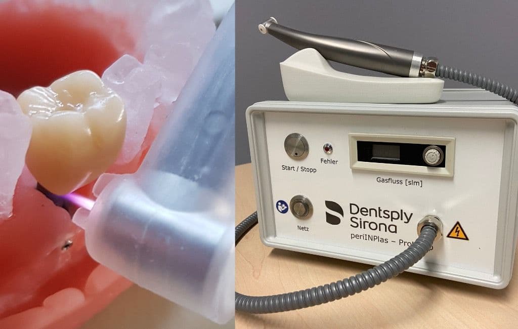 Periimplantitisbehandlung