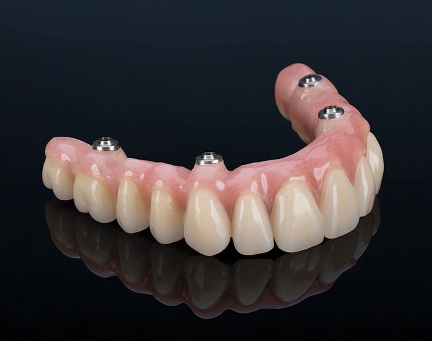 perspektivwechsel_permadental_4_2014_permadental_Abb_2
