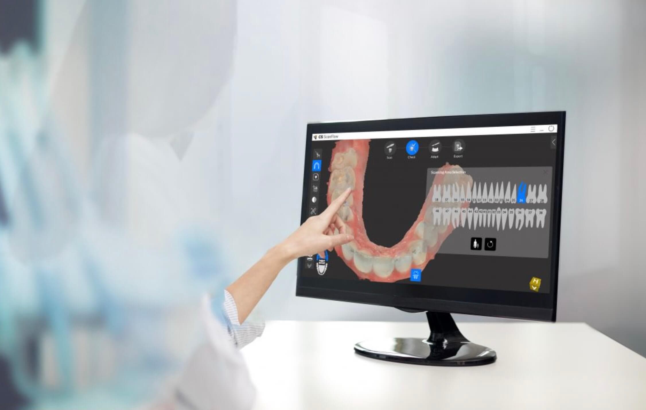 Intraoralscanner
