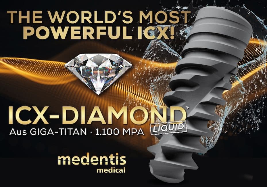 ICX-DIAMOND