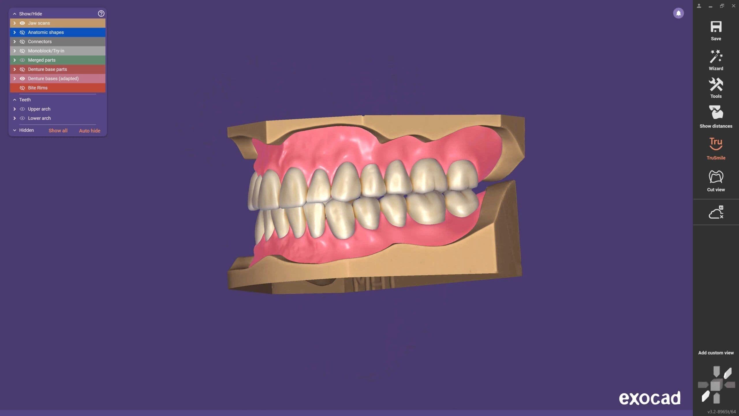 Inspira Denture