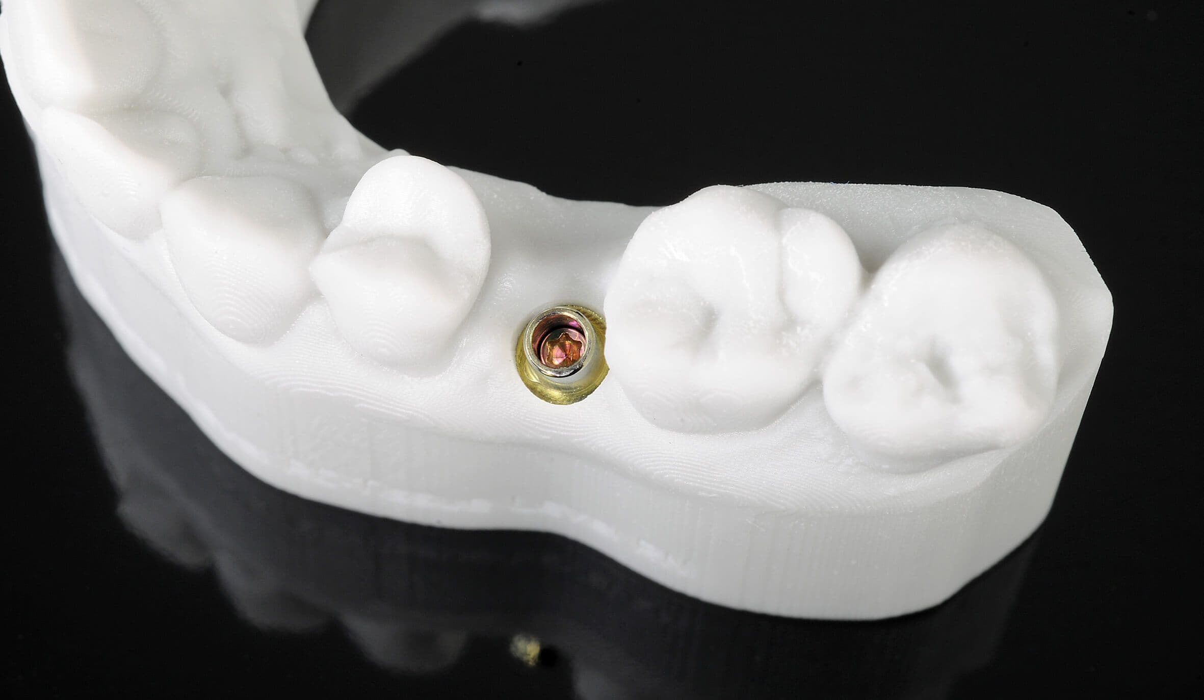 shera_4_implants_DSC_7572 Kopie