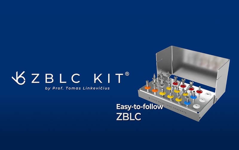 ZBLC-Zero Bone Loss Concept