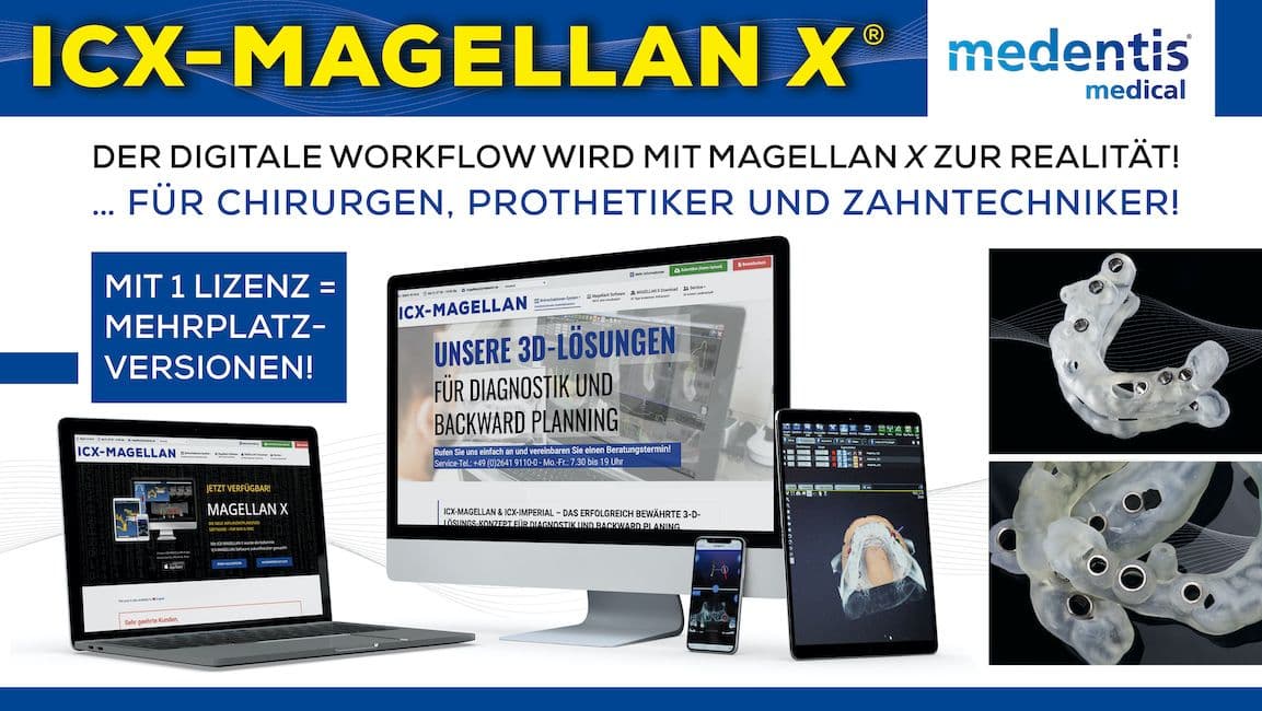 ICX-Magellan