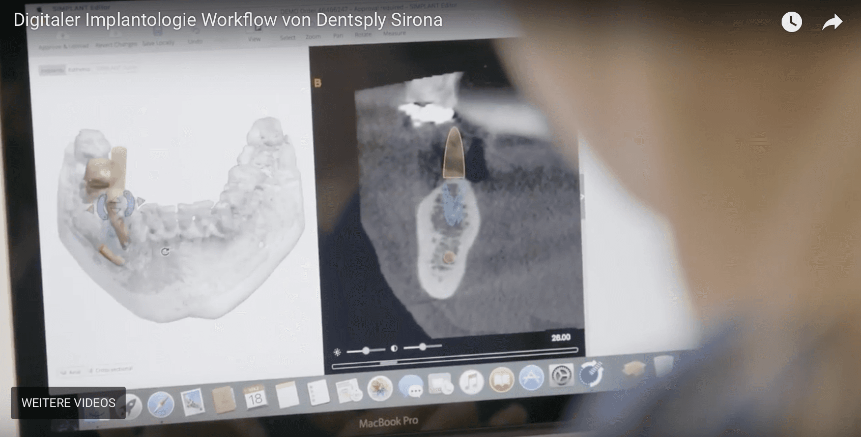 Dentsply_Sirona_digital_web