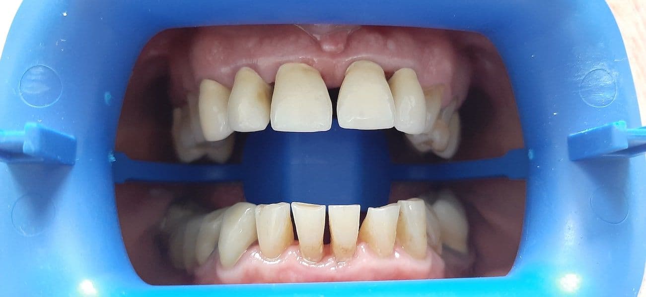 Oxysafe Gel