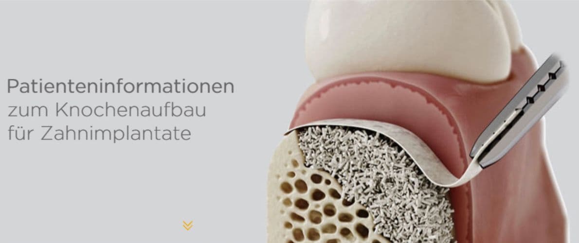 Knochenaufbau