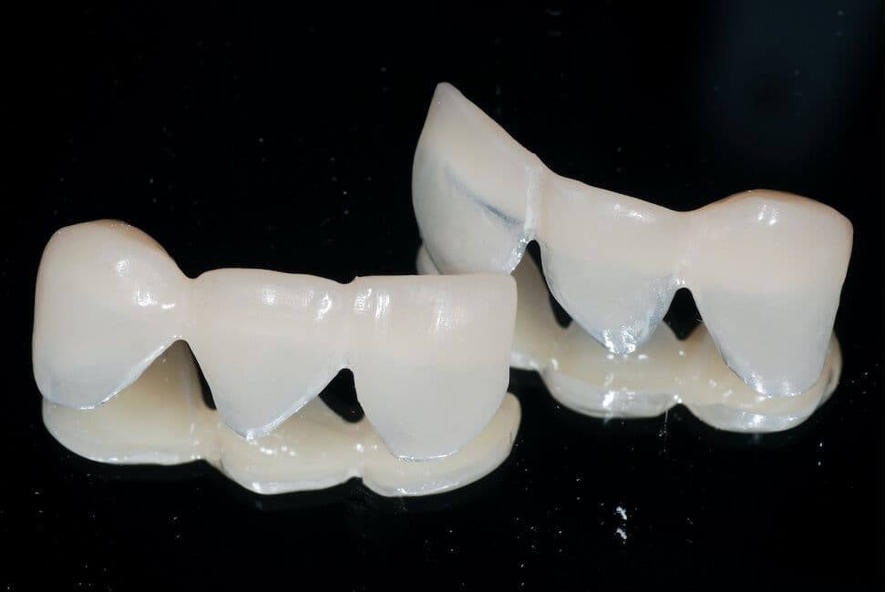 Cerec-Tag