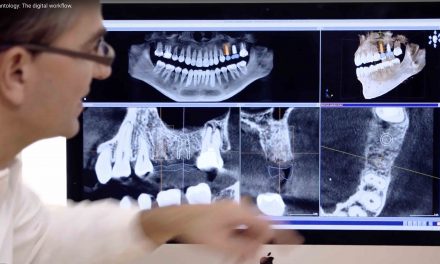 Video: Der digitale Workflow in der Implantologie
