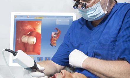 Digitaler Implantologie-Workflow von Dentsply Sirona