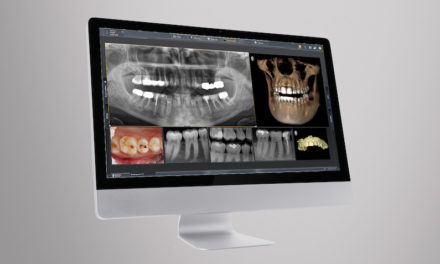 Digitales Röntgen wird smarter und individueller