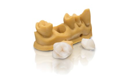 VarseoSmile Crown – für den 3D-Druck von permanenten Einzelkronen, Inlays, Onlays und Veneers