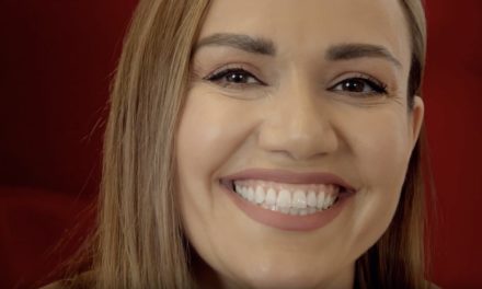 Video: Wie Adisa mit DCM Hotbond ihr Lächeln wieder erhielt