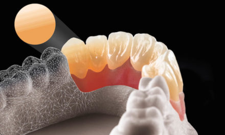 dentaltrade: Natürliche Ergebnisse mit Multilayer-Zirkonoxid