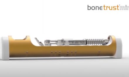 Zweiteilig, verschraubt – BoneTrust Mini-Implantate