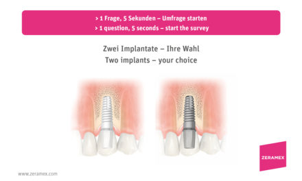 Zeramex Umfrage: Welches Implantat würden Sie wählen?