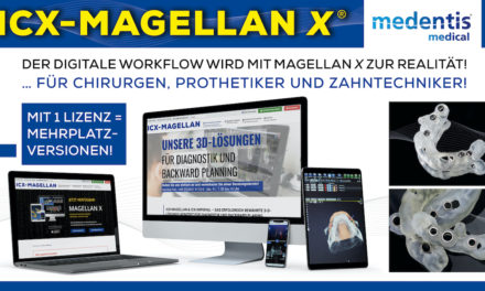 ICX-Magellan und ICX-Imperial: Die bewährte 3D-Lösung für Diagnostik und Backward Planning