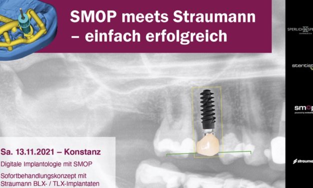 SMOP meets Straumann: Digitale Implantologie mit SMOP