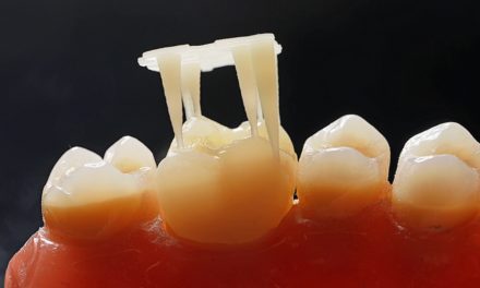 Cerec-Tag 2021: Workshop zum 3D-Druck in der Zahnarztpraxis