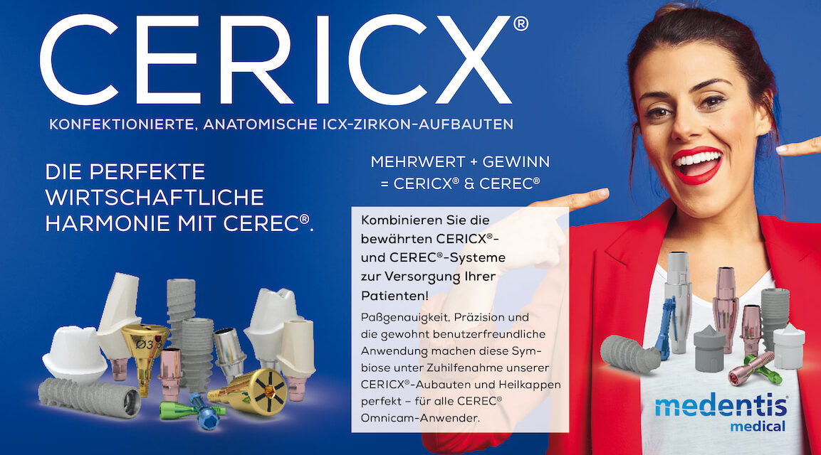 CERICX-Aufbauten für alle ICX-Implantate