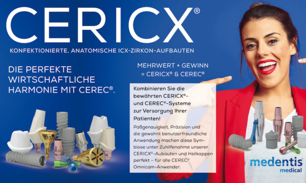 CERICX-Aufbauten für alle ICX-Implantate