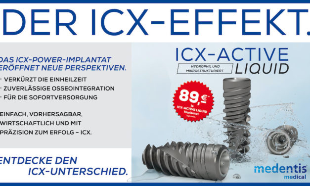 Erlebe den ICX-Effekt