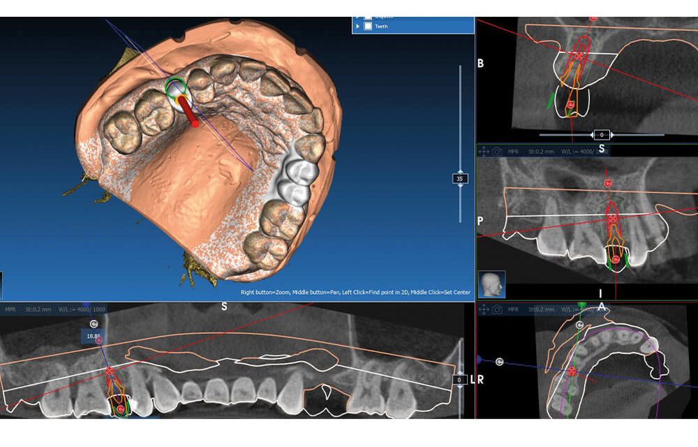 medentis medical: Die Evolution der dentalen Implantologie
